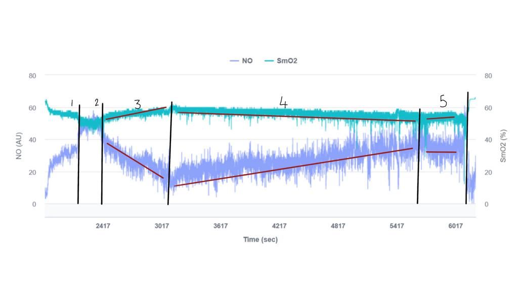 NNOXX One High Performance Platform