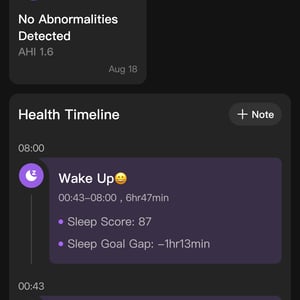 Ringconn Review - 8 Pros ✔️ 2 Cons ❌