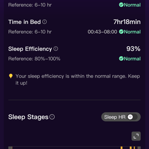 Ringconn Review - 8 Pros ✔️ 2 Cons ❌