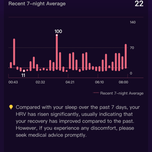 Ringconn Review - 8 Pros ✔️ 2 Cons ❌