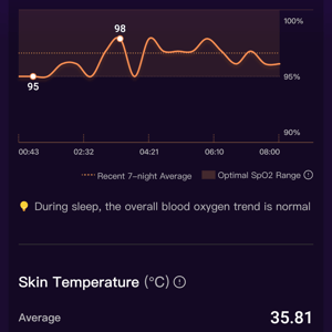 Ringconn Review - 8 Pros ✔️ 2 Cons ❌