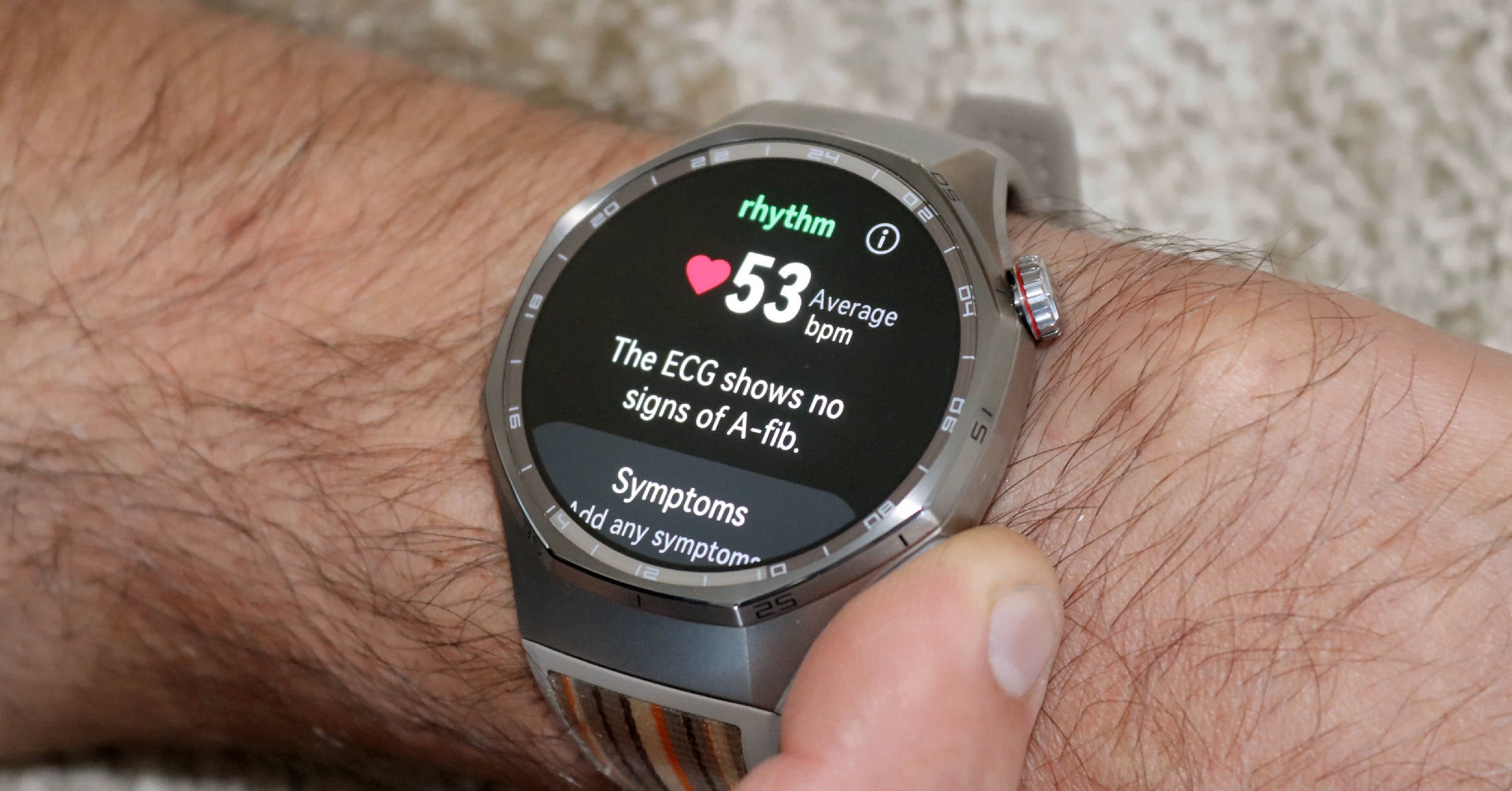 Huawei Watch GT 6 Pro ECG test result showing normal sinus rhythm