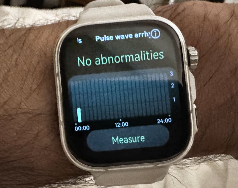 Huawei Watch Fit 5 Pro Pulse Wave Arrhythmia analysis reporting normal across continuous monitoring