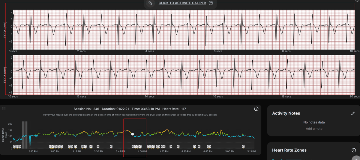 Fourth Frontier ECG trace showing manually logged heart events with 20-second zoomed view for cardiologist review