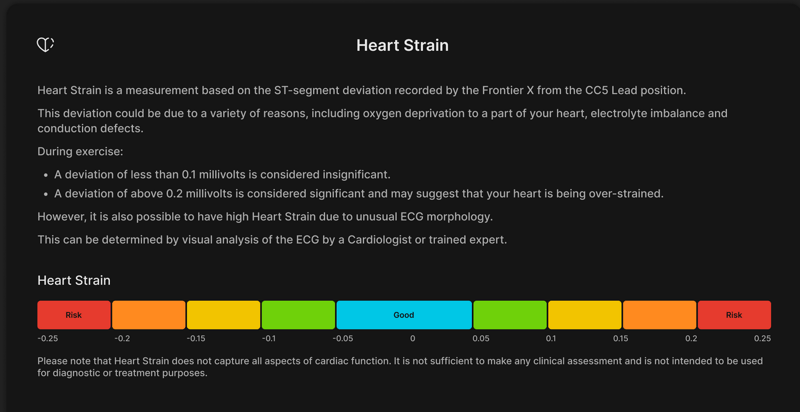 Frontier ZONE heart strain chart showing ST segment deviation during 150-minute ride