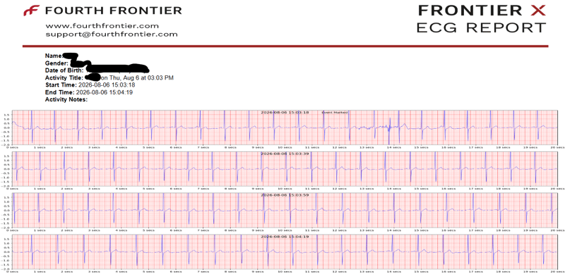 Fourth Frontier X Plus ECG trace