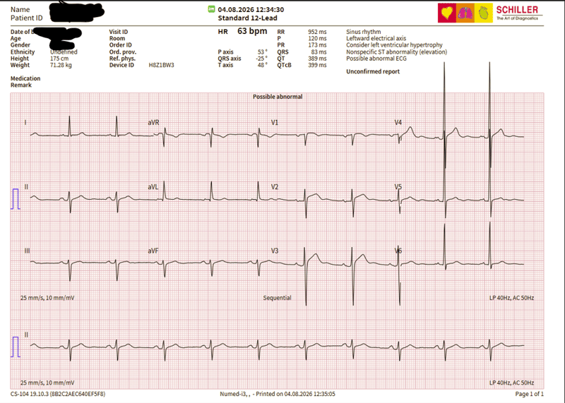 Clinical 12-lead ECG trace