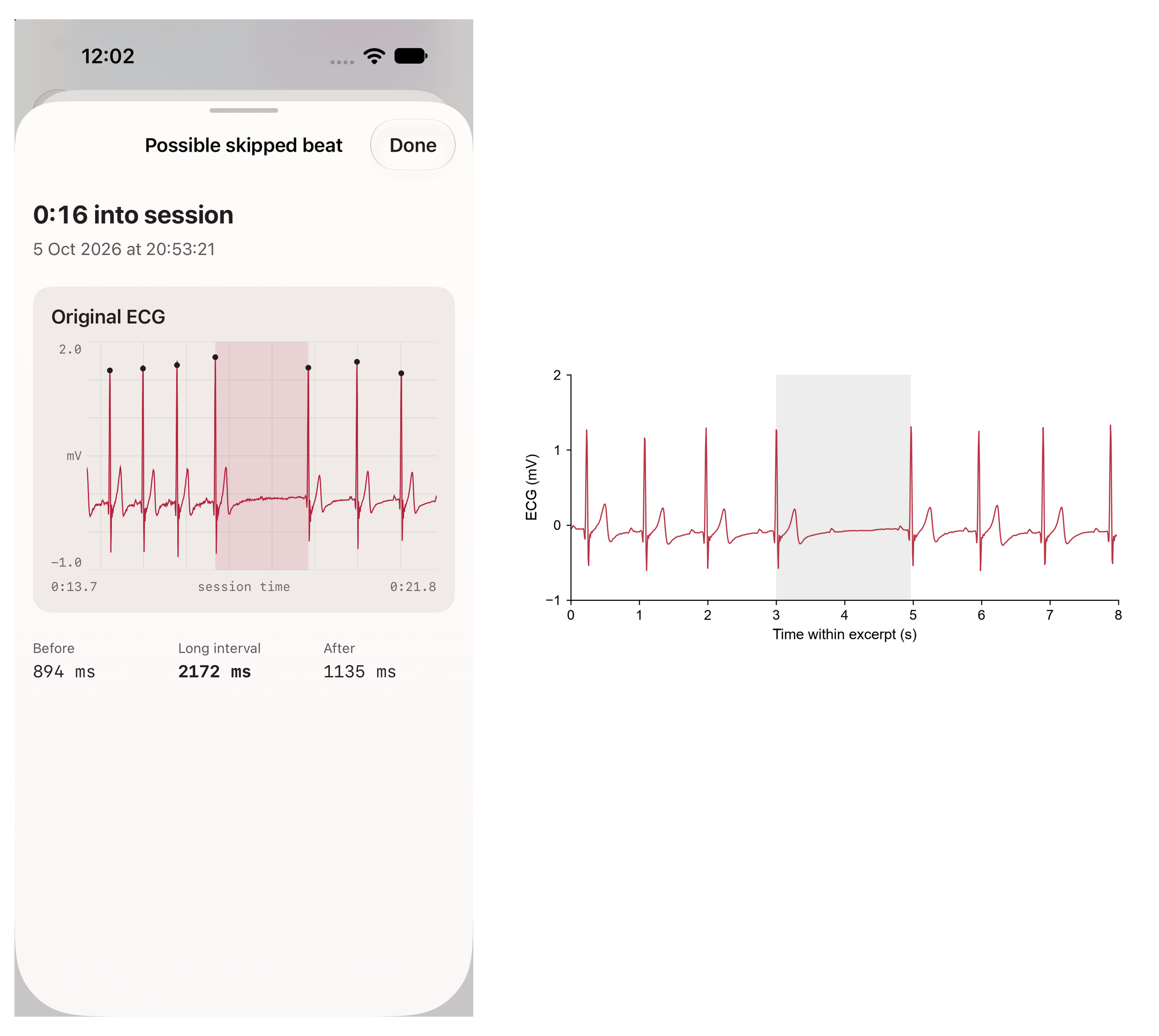 Sympathetic single-lead ECG view from a Polar H10 beside an excerpt of an overnight ECG recording