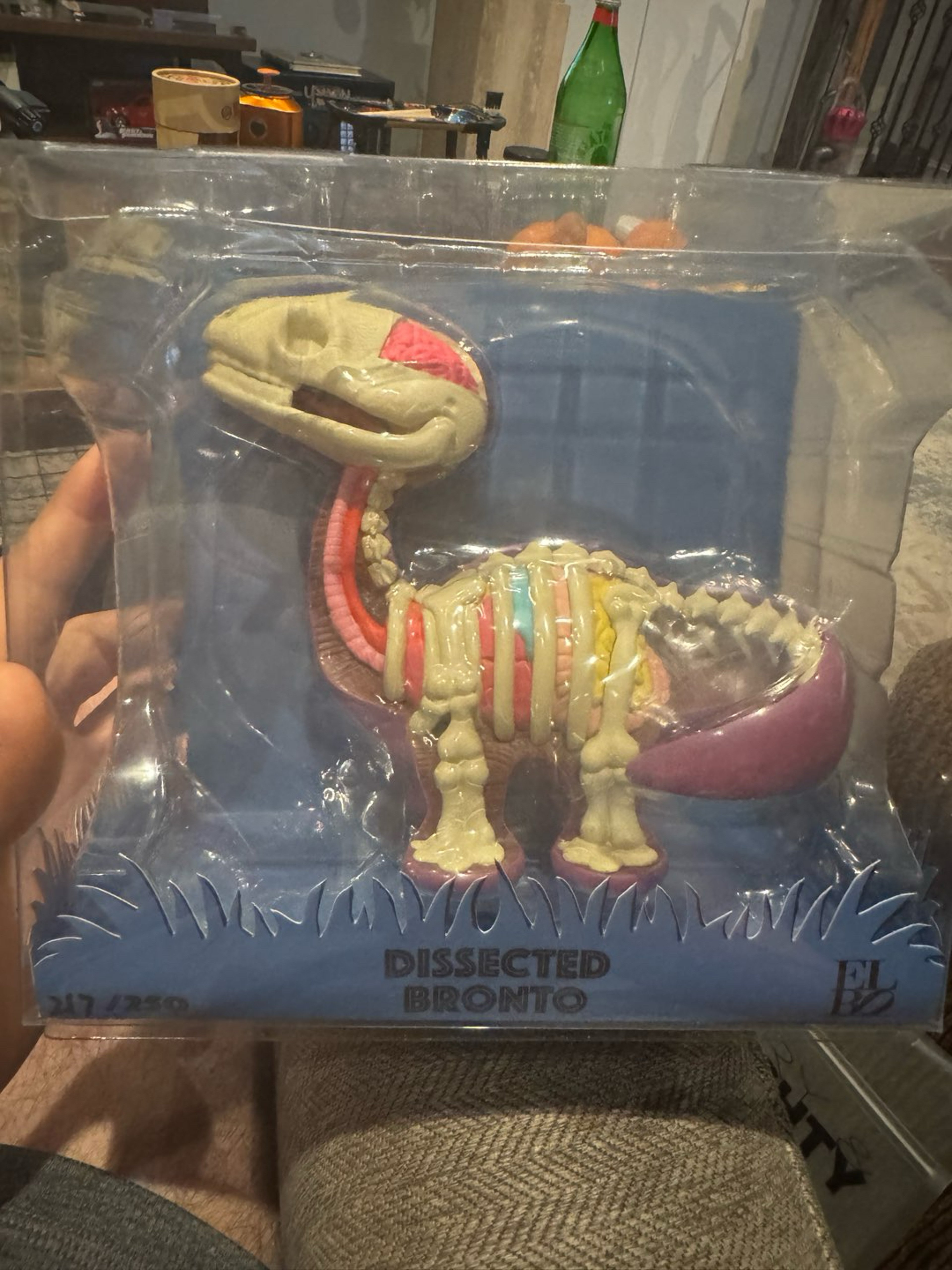Preview pic of elbo dissected bronto