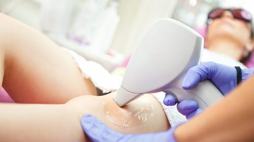 Depilação laser corpo-38-351