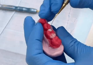 Imagem do produto Restauração Dentária Indireta – Mais Resistência e Durabilidade