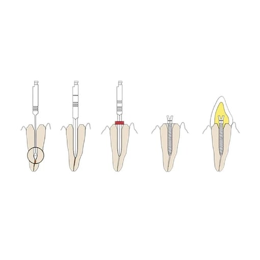 VÁRIOS Kit Screw-Posts Dourados (240uni)