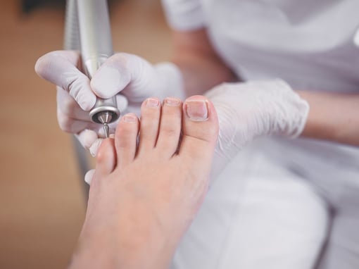 Pedicure Medical Onicogrifose
