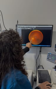 Imagem do produto Programa de Readaptação de Lentes Ortho-K