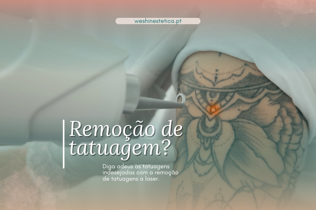 Remoção de Tatuagens a Laser: Tecnologia Segura e Eficaz