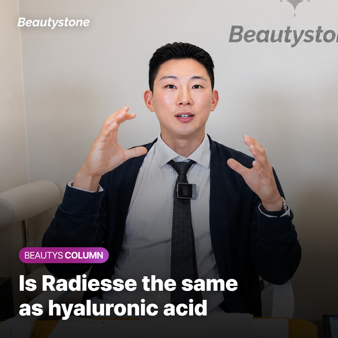 Radiesse filler before and after treatment