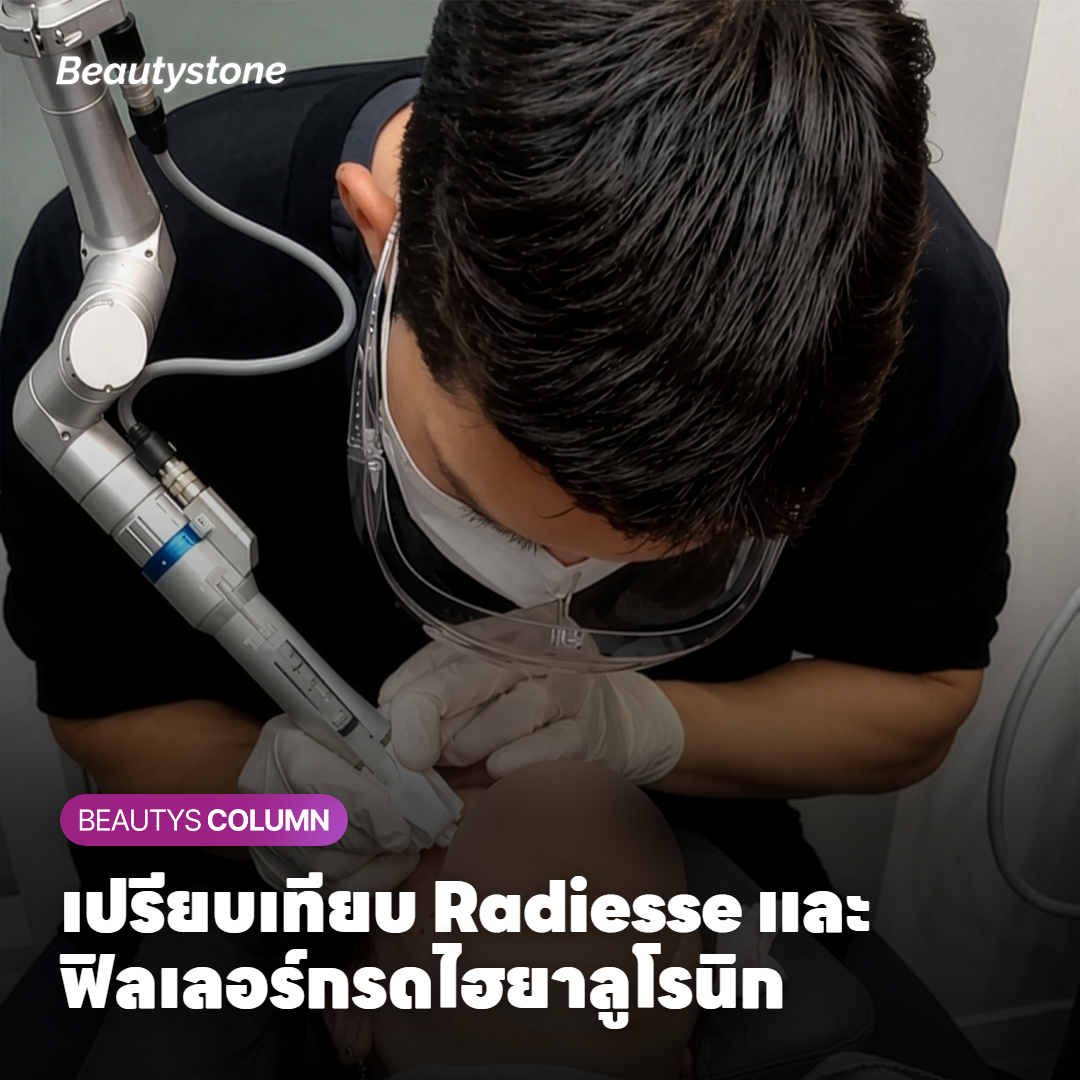 เปรียบเทียบ Radiesse และฟิลเลอร์กรดไฮยาลูโรนิก