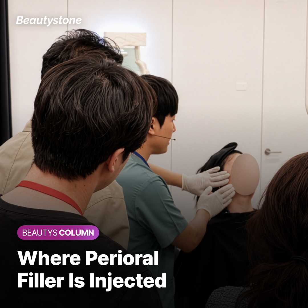 Perioral filler injection location