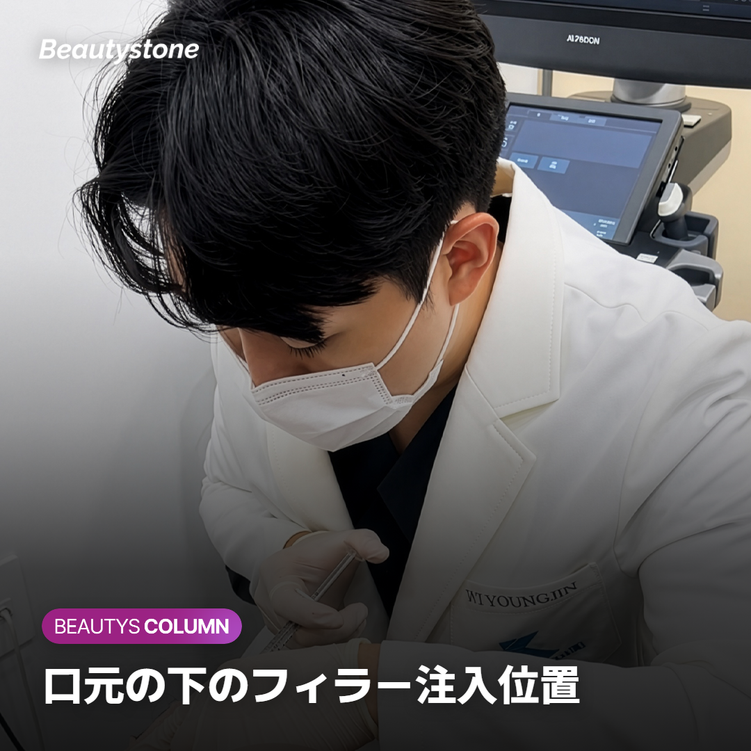 口元の下のフィラー注入位置