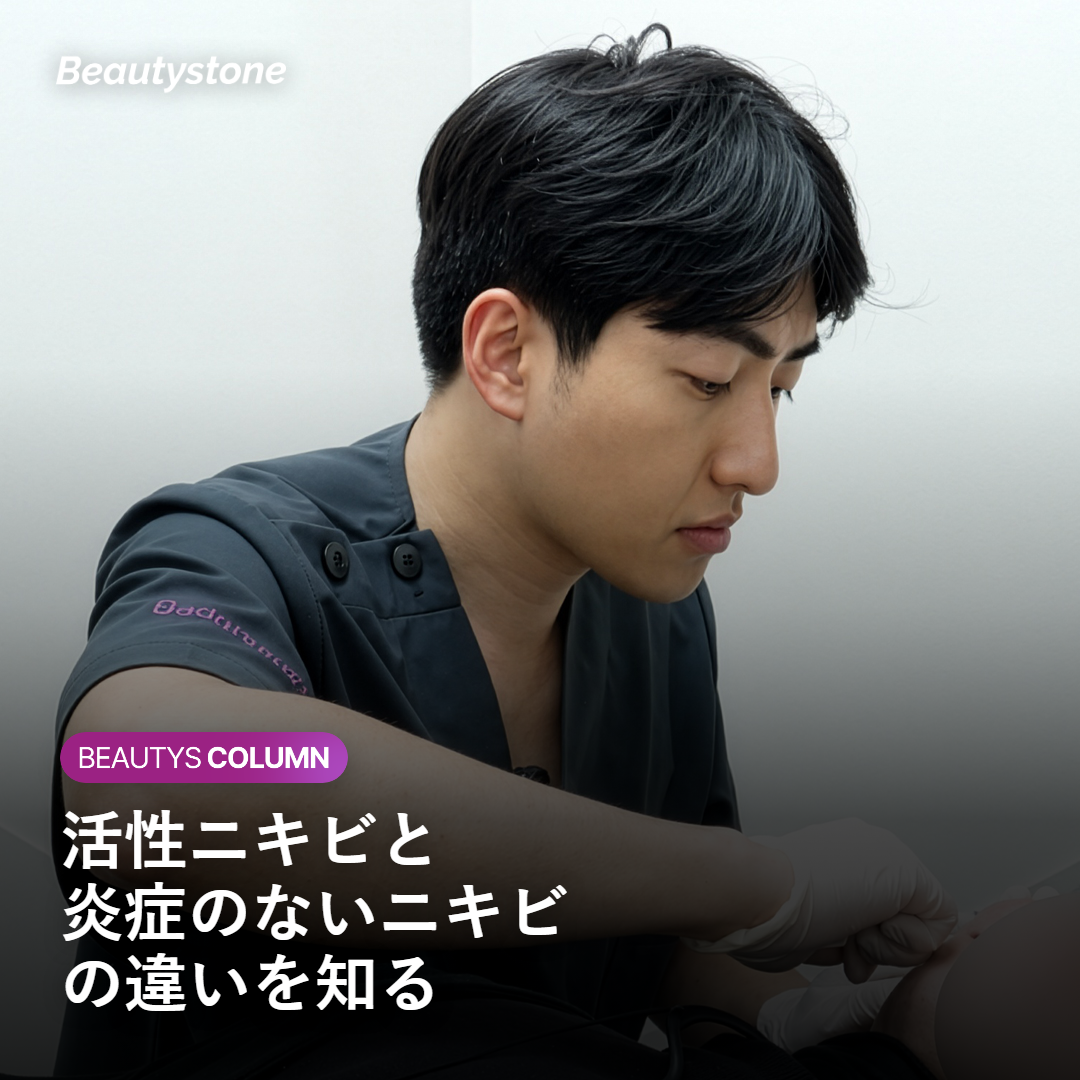 活性ニキビとはどのような状態か