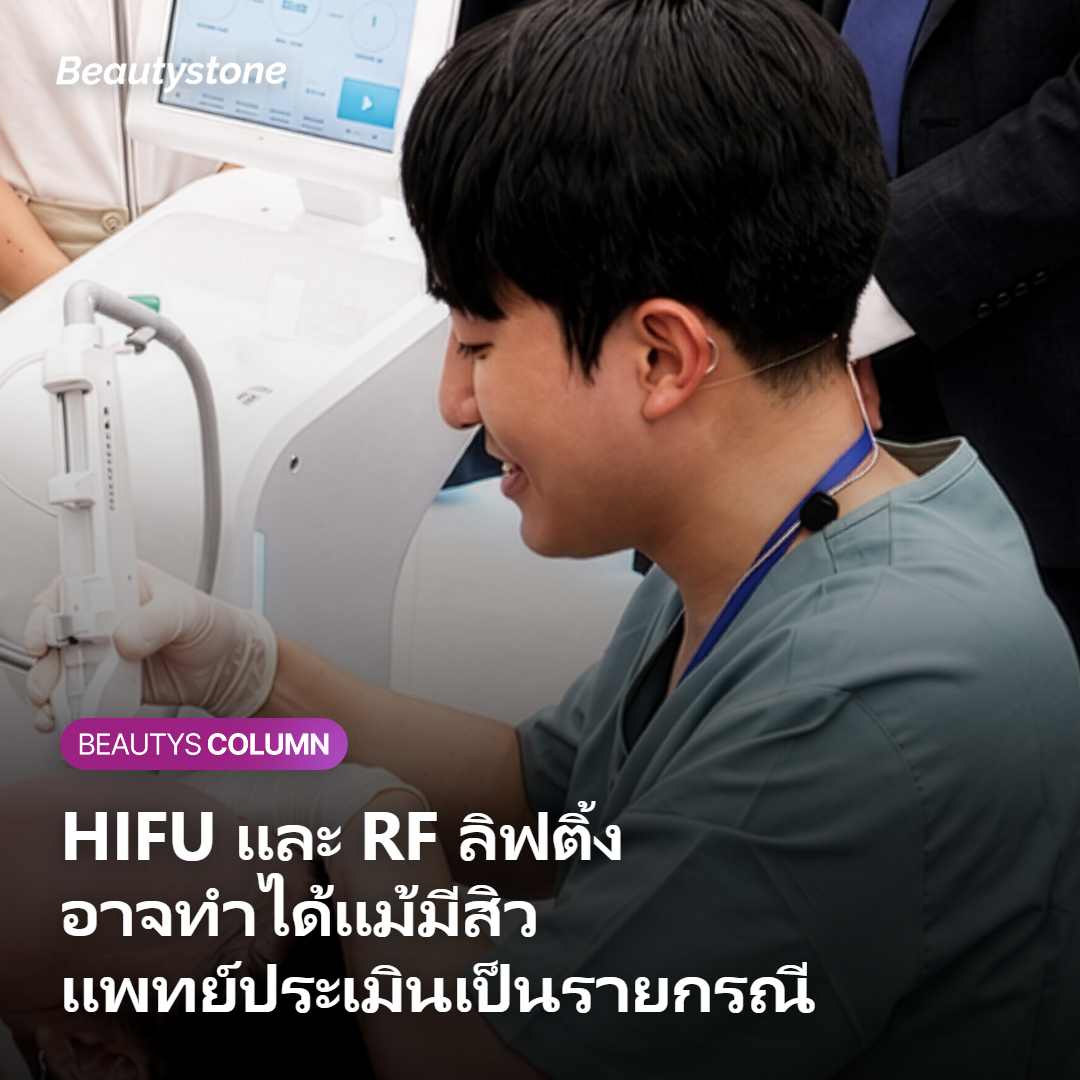หัตถการไหนทำได้เลยแม้มีสิวอักเสบ?