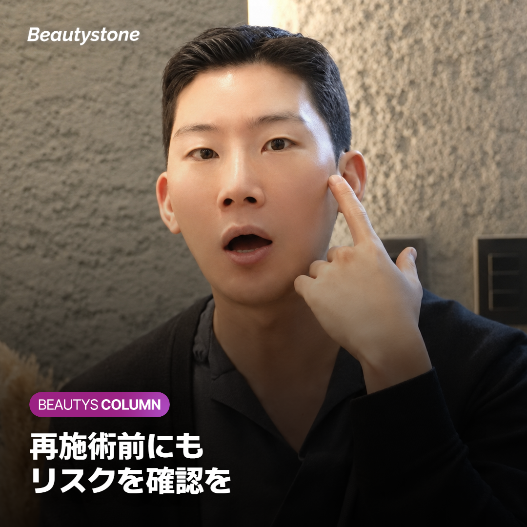 ダウンタイムとリスクについて