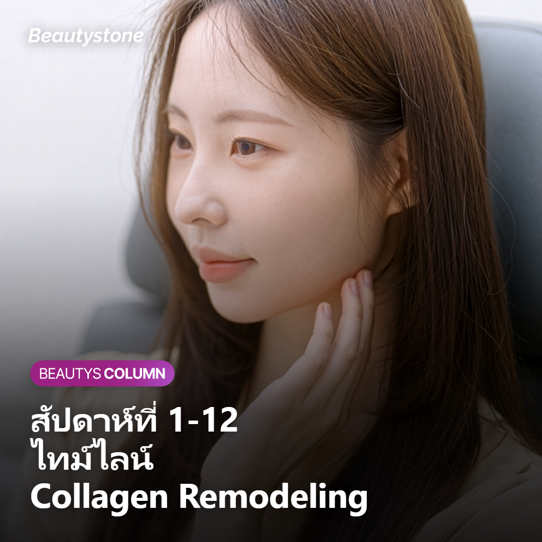 กลไก Collagen Remodeling จาก RF ในชั้นหนังแท้