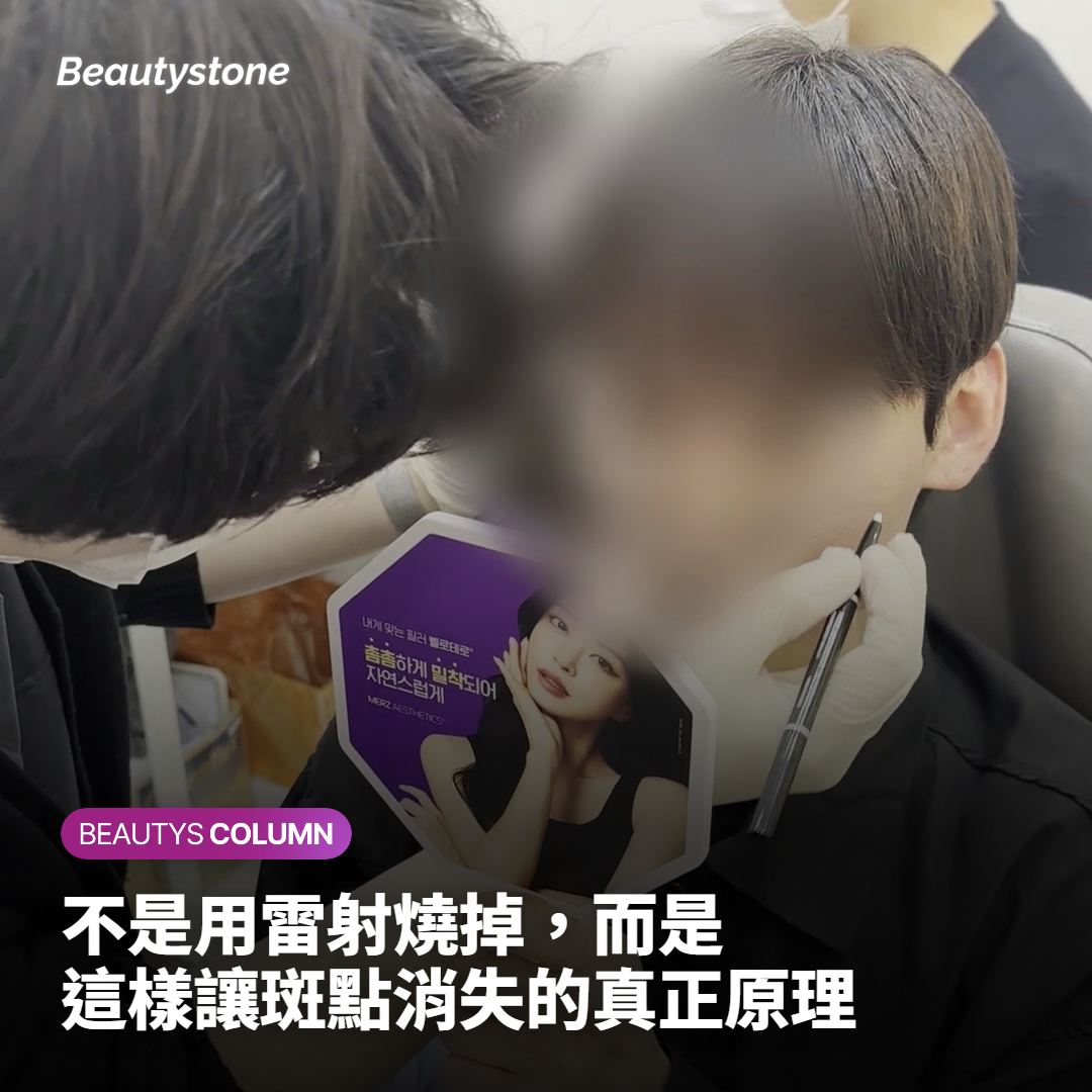 不是用雷射燒掉，而是這樣讓斑點消失的真正原理