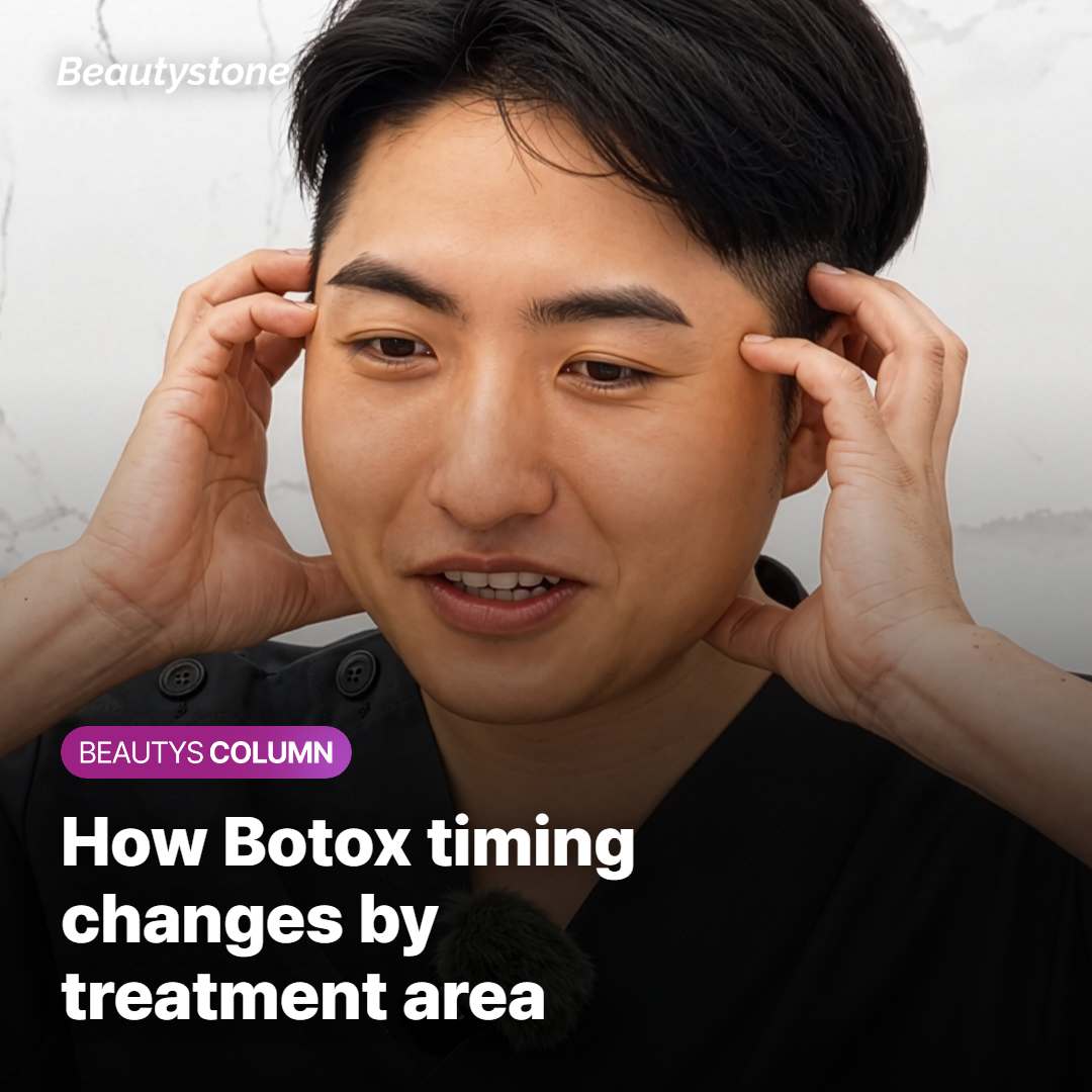 Botox results timeline by treatment area