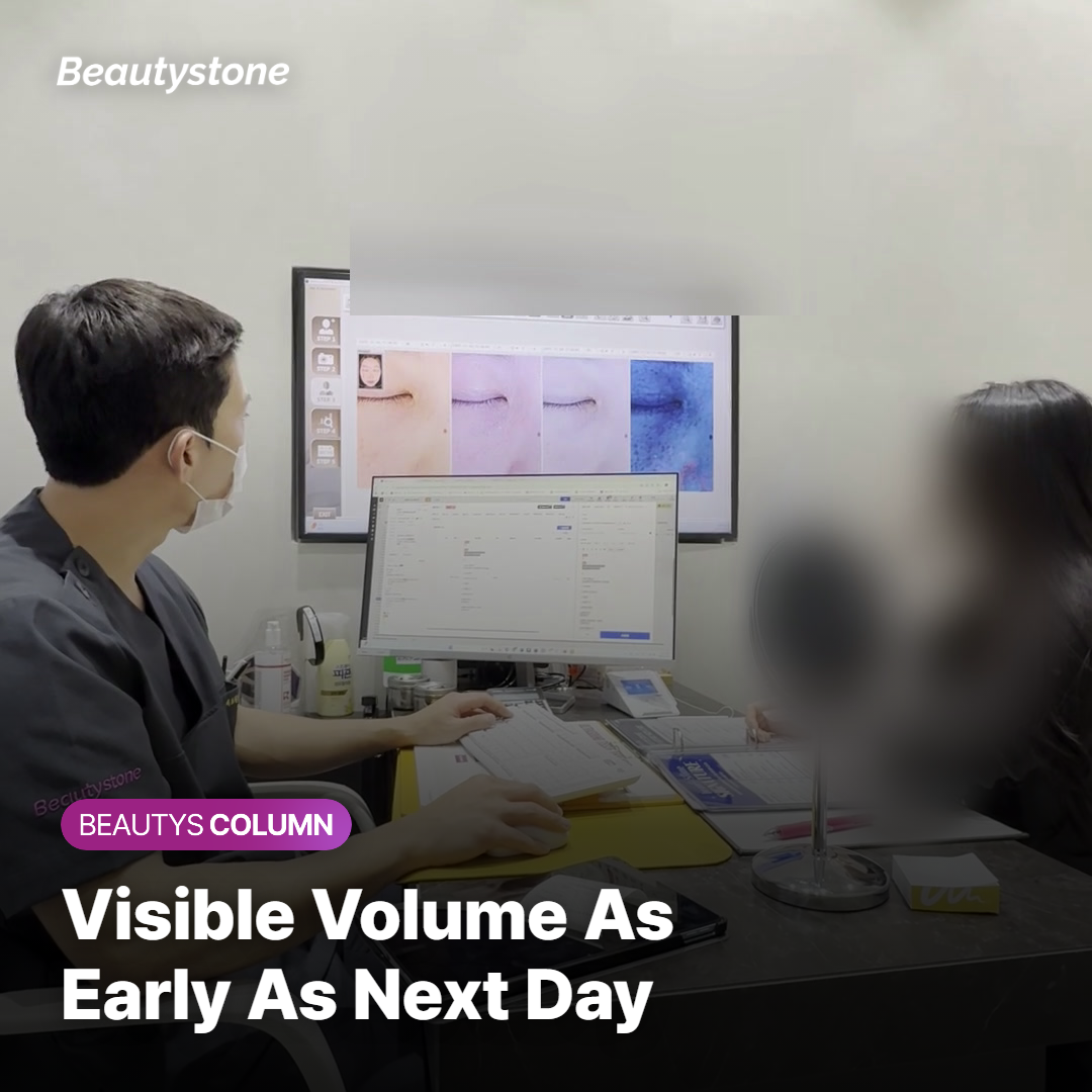 Visible volume the very next day