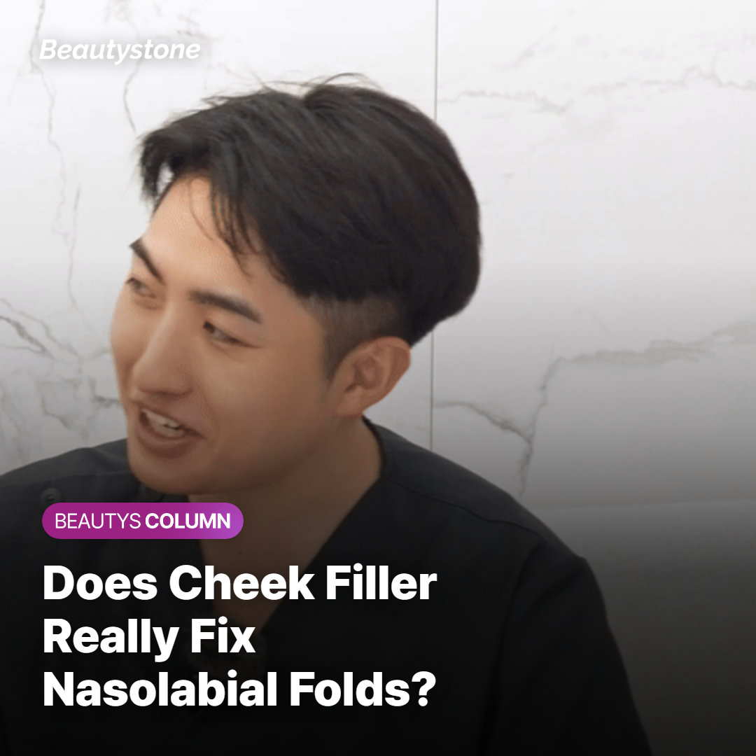 Diagram explaining how cheek filler improves nasolabial folds