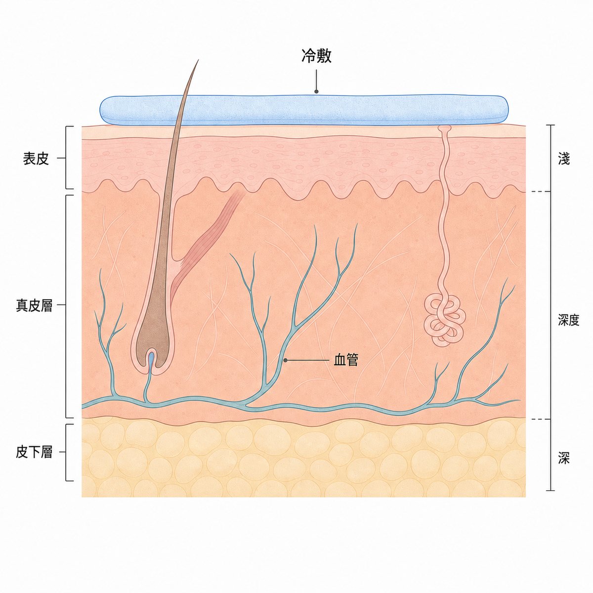 冷刺激使血管收縮的示意圖