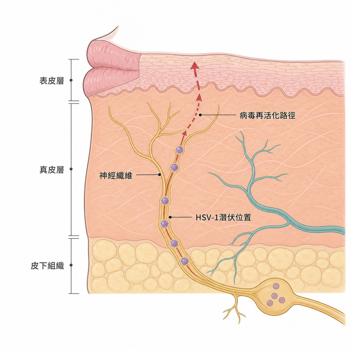 HSV-1病毒潛伏於三叉神經節並沿神經纖維再活化的皮膚截面示意圖