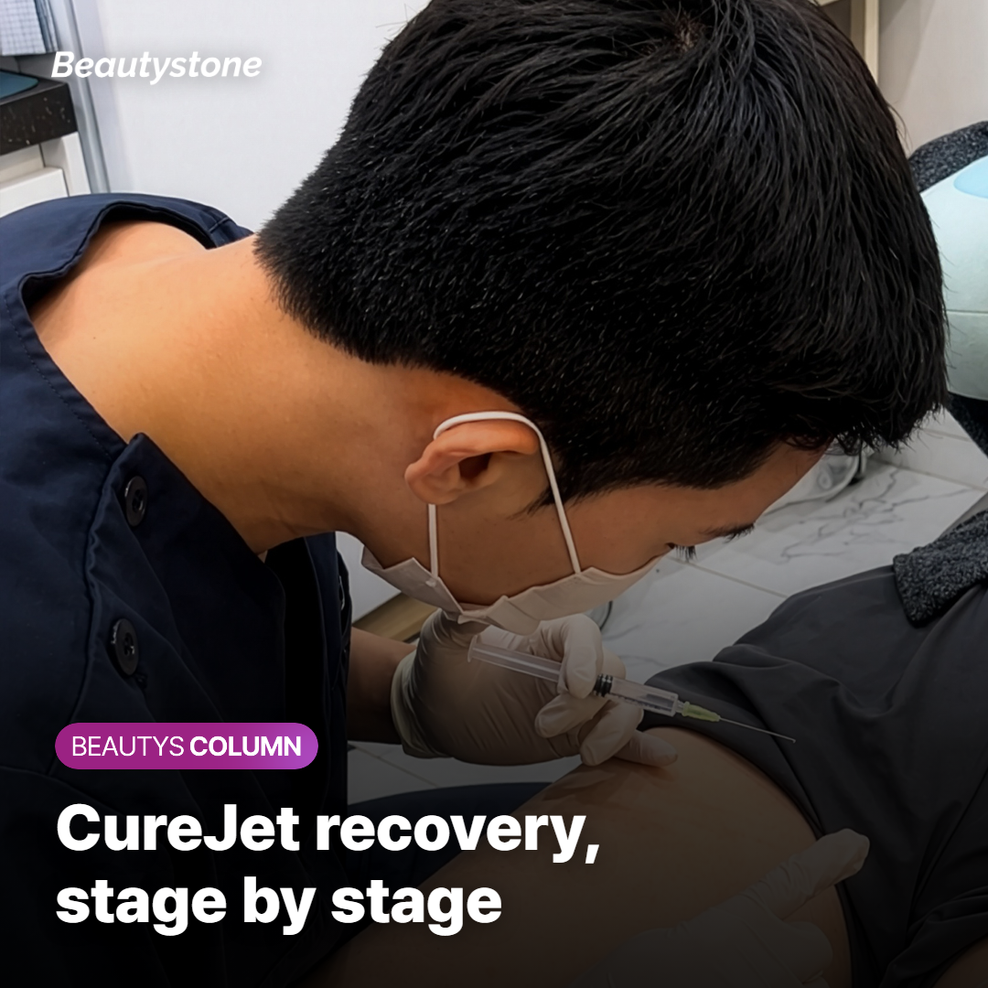 Stage-by-stage recovery changes after CureJet