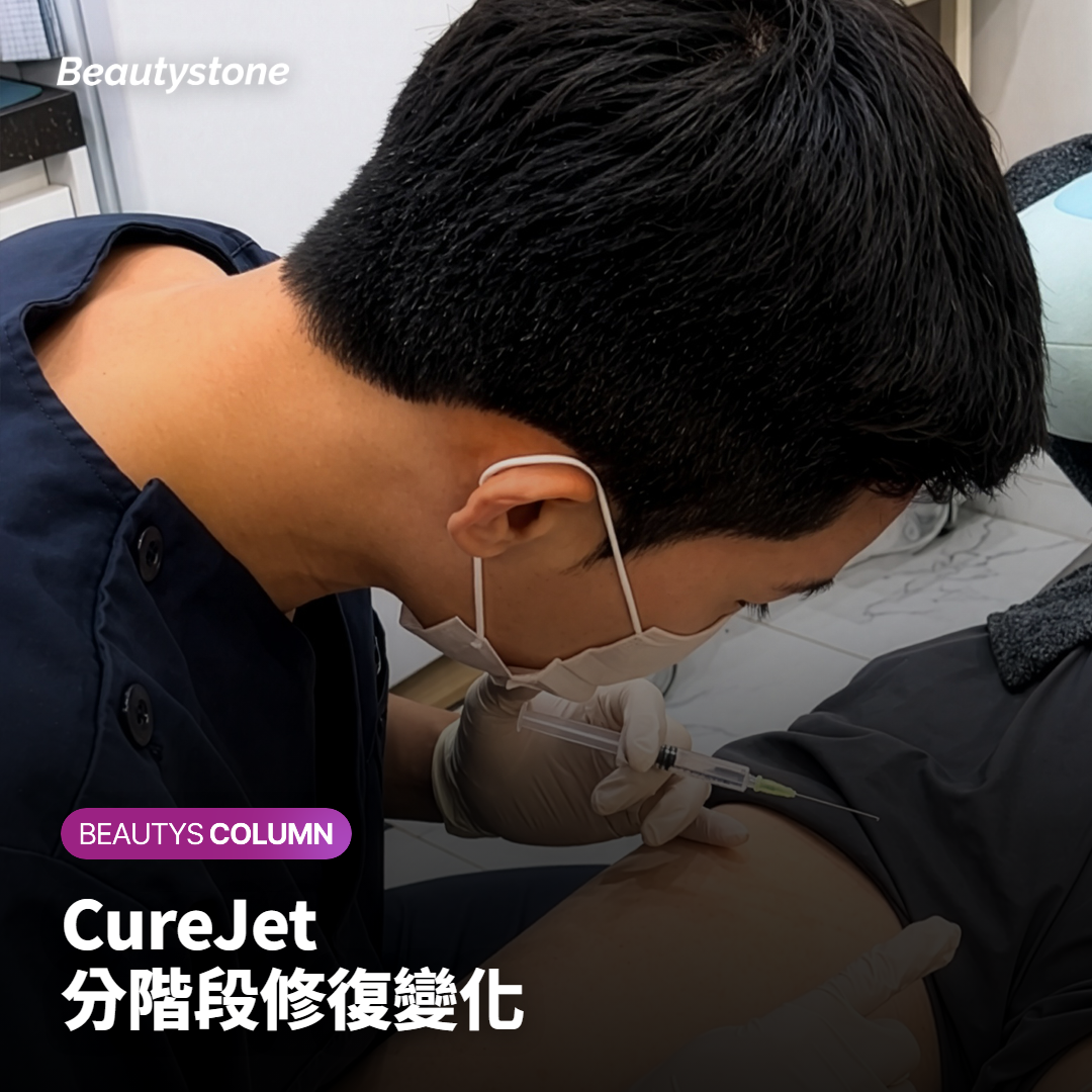 CureJet分階段修復變化