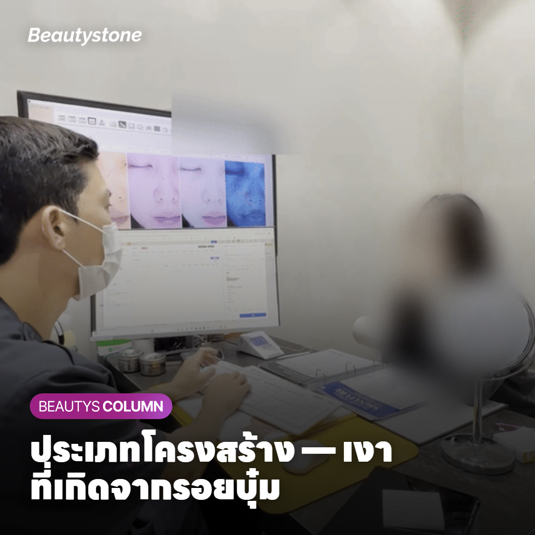 ประเภทโครงสร้าง — เงาที่เกิดจากรอยบุ๋ม