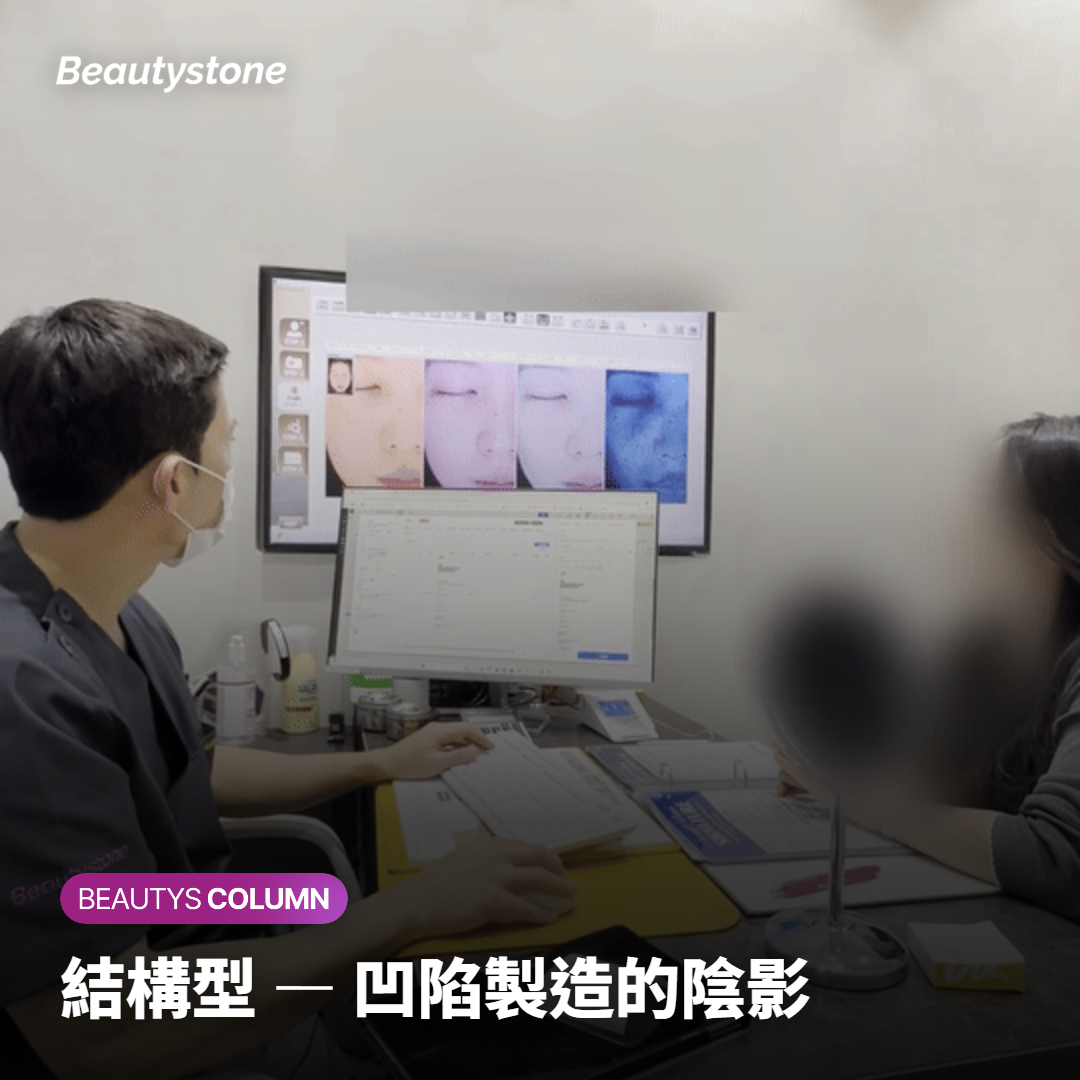 結構型 — 凹陷製造的陰影