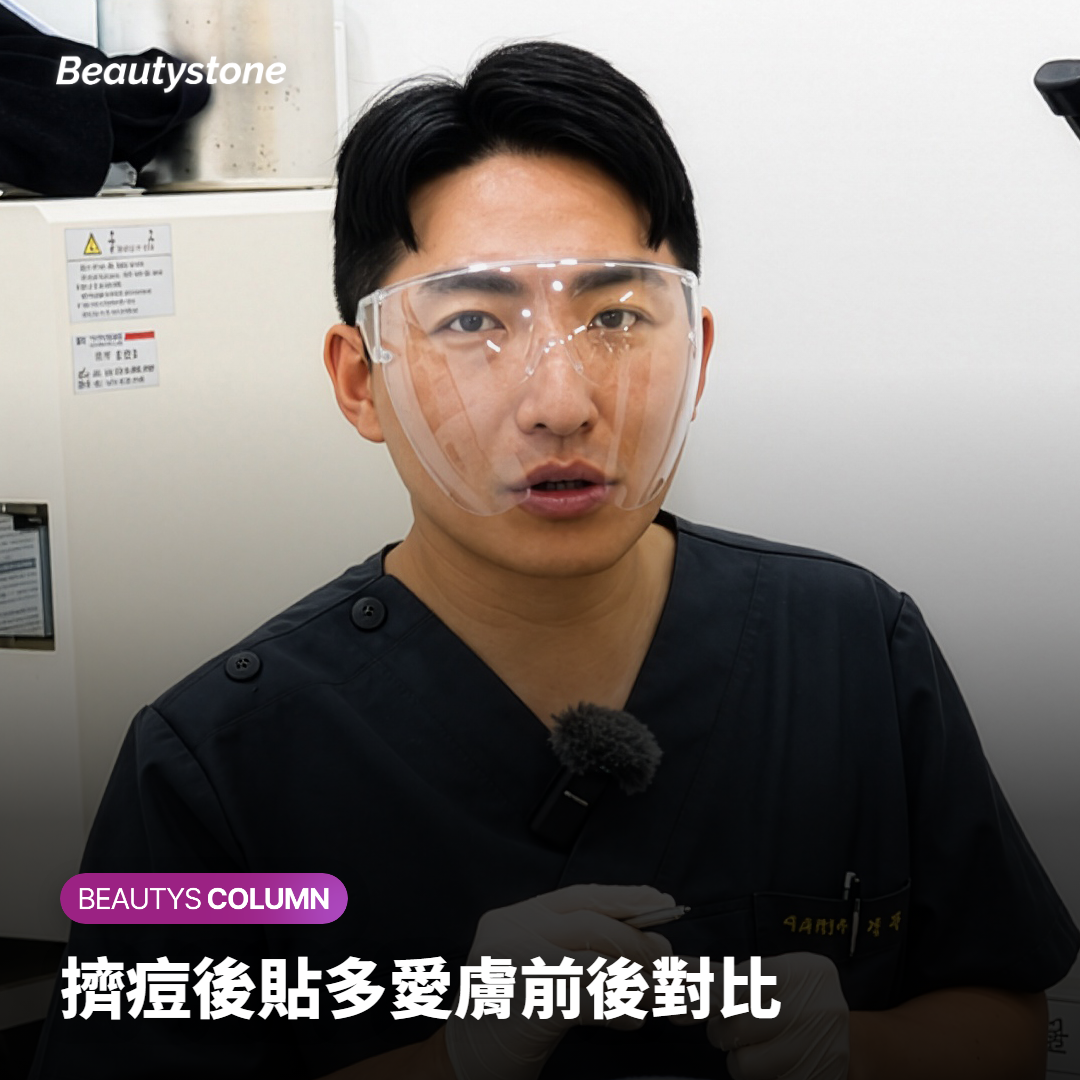 擠痘後貼多愛膚前後對比
