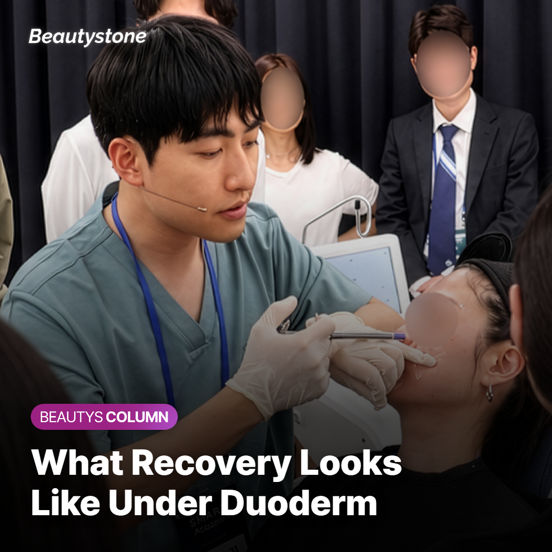 Recovery process after applying Duoderm