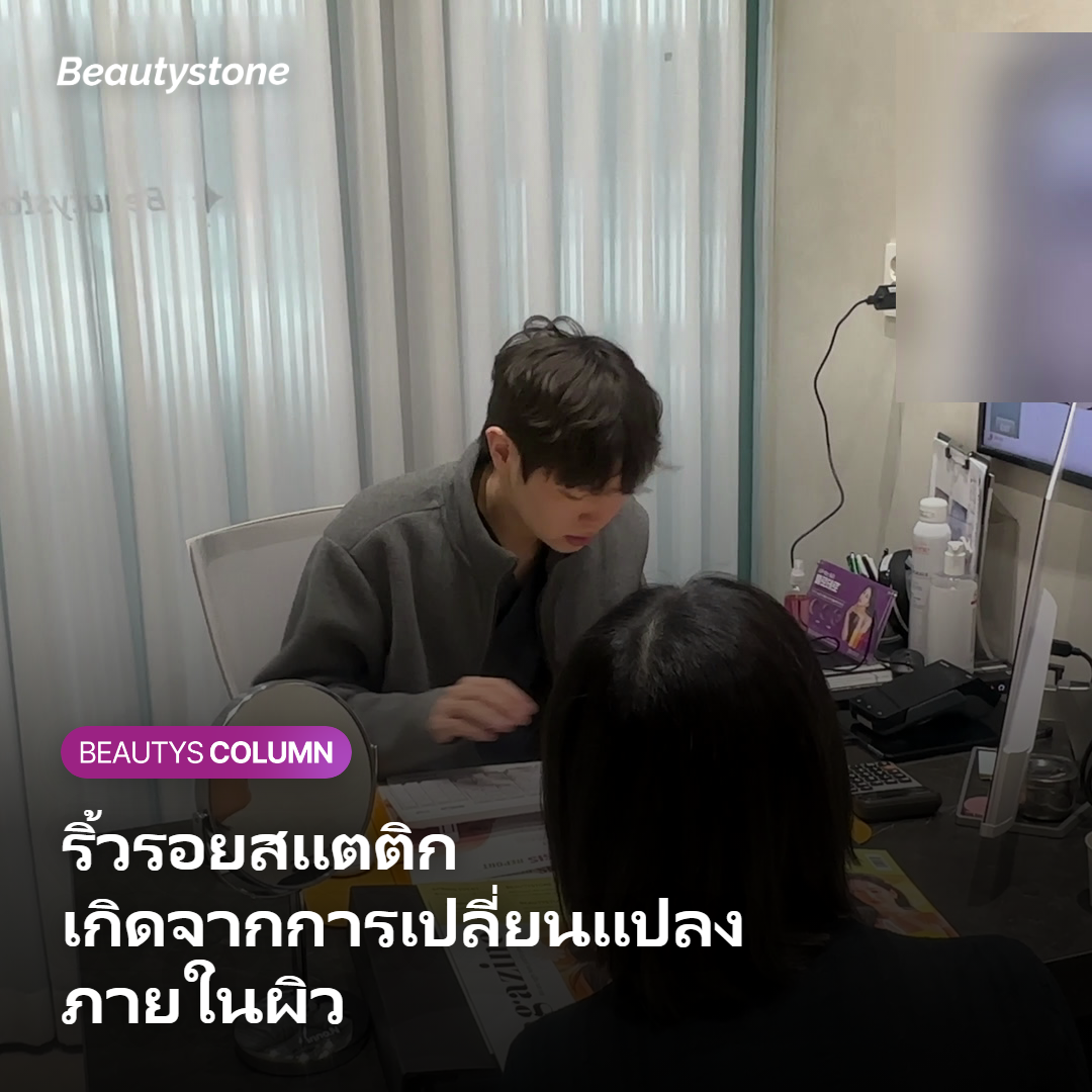 ภาพแสดงว่าริ้วรอยแบบสแตติกเกิดจากการเปลี่ยนแปลงภายในผิว