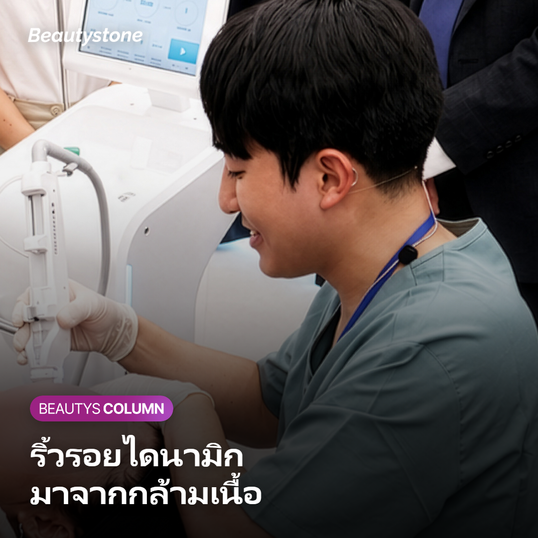ภาพแสดงว่าริ้วรอยแบบไดนามิกมาจากการเคลื่อนไหวของกล้ามเนื้อใบหน้า