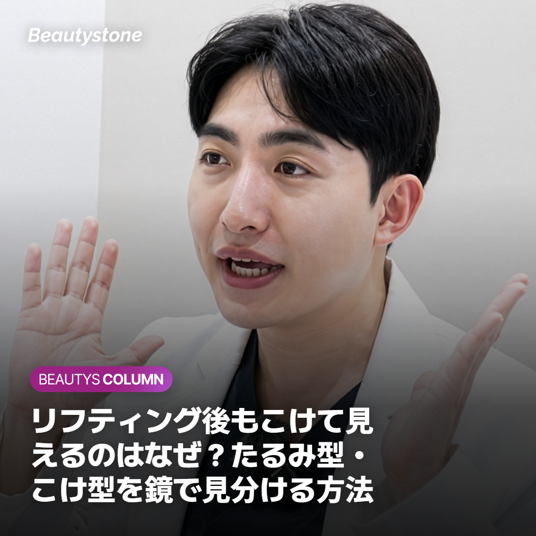 リフティング後もこけて見えるのはなぜ？たるみ型・こけ型を鏡で見分ける方法