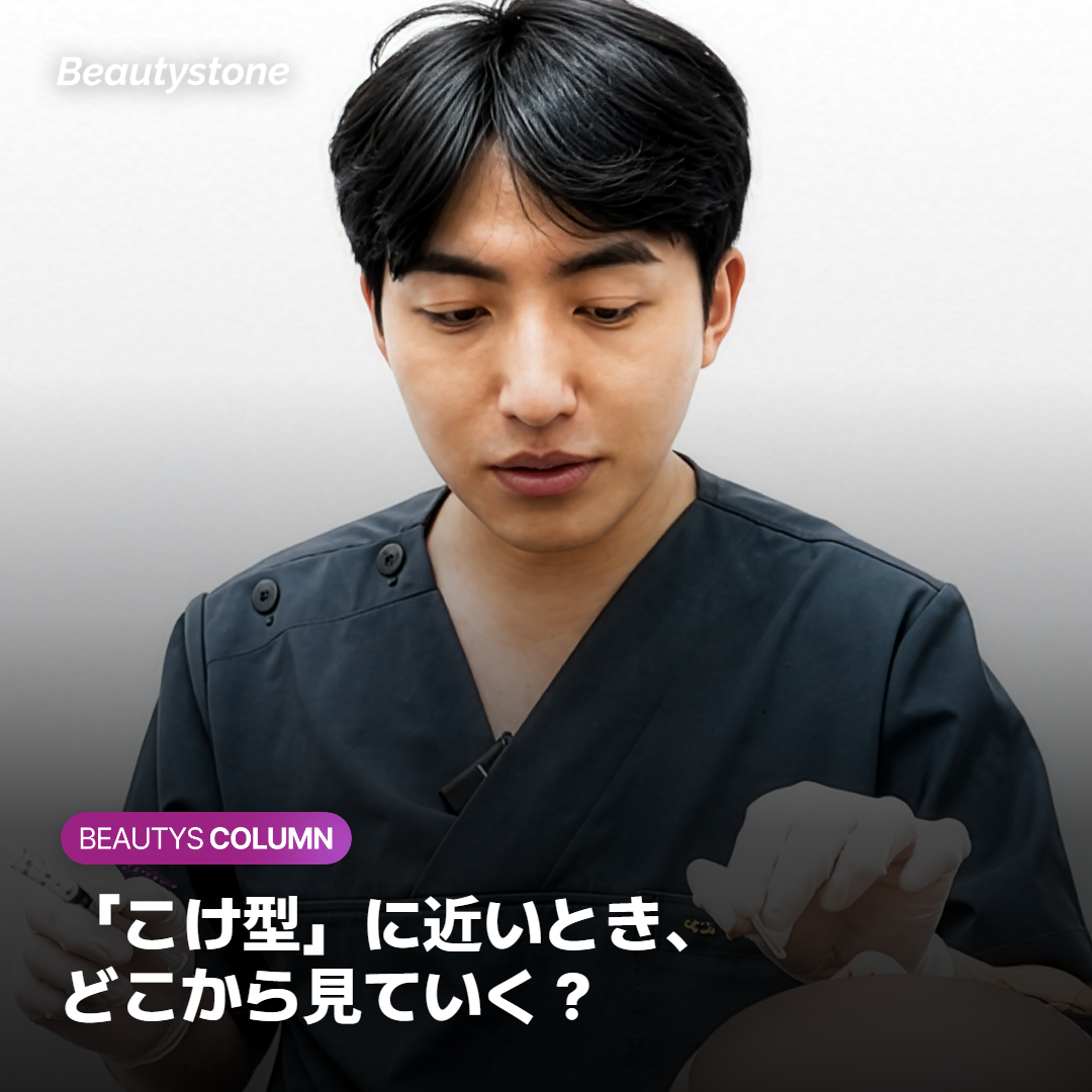 「こけ型」に近いとき、どこから見ていく？