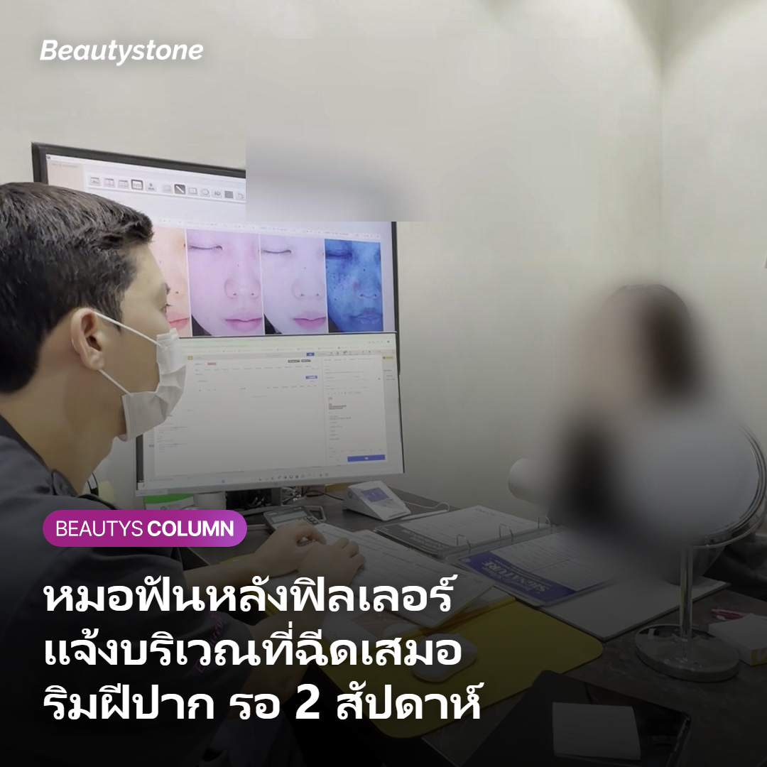 ตารางข้อห้ามและระยะเวลาที่ต้องรอหลังฉีดฟิลเลอร์
