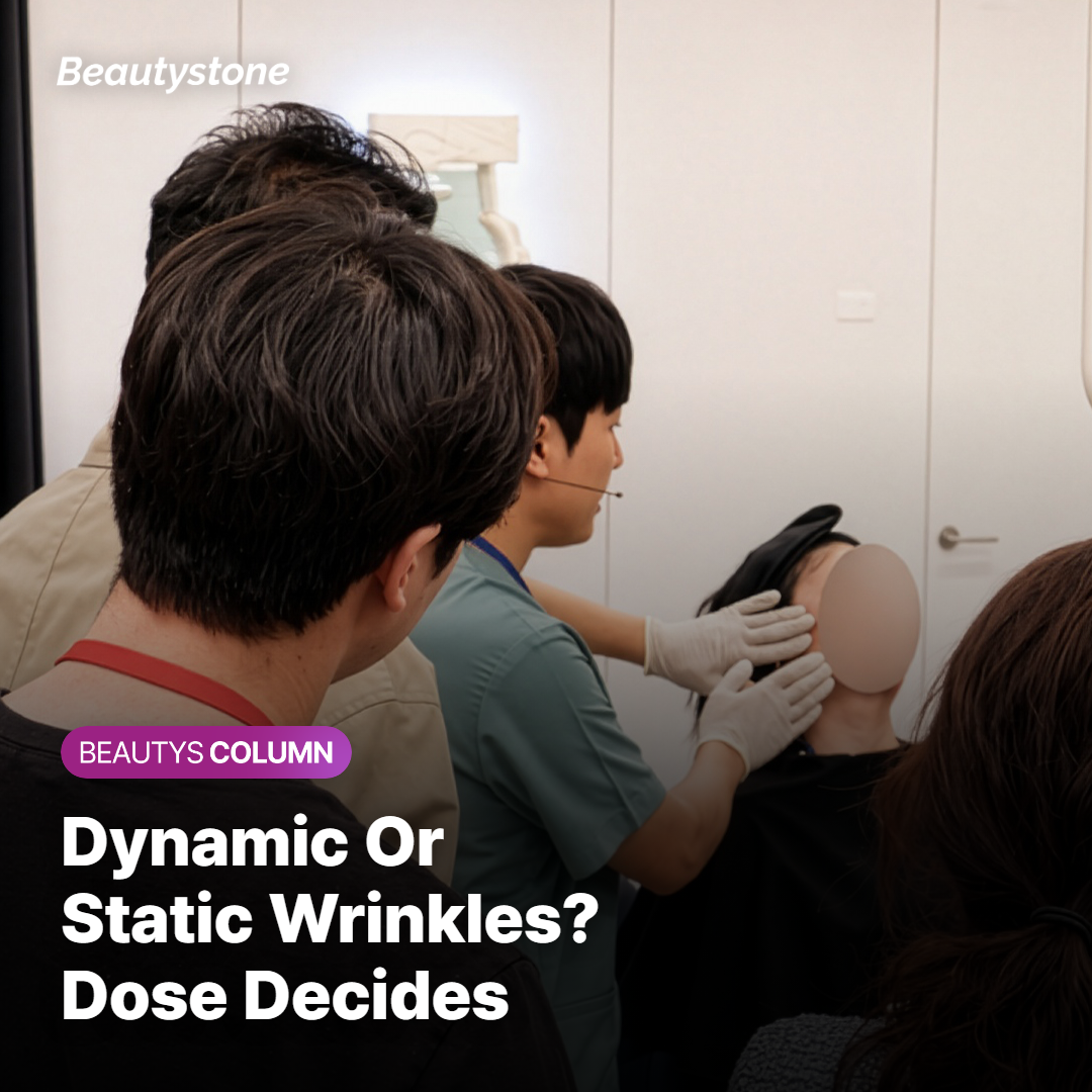 Dynamic vs. static wrinkles — a guide to choosing the right treatment for your forehead wrinkle type
