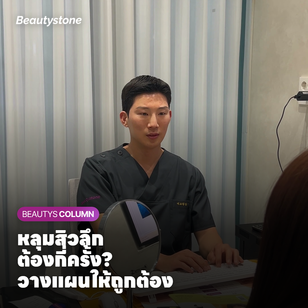 หลุมสิวลึก ต้องกี่ครั้ง? วางแผนให้ถูกต้อง