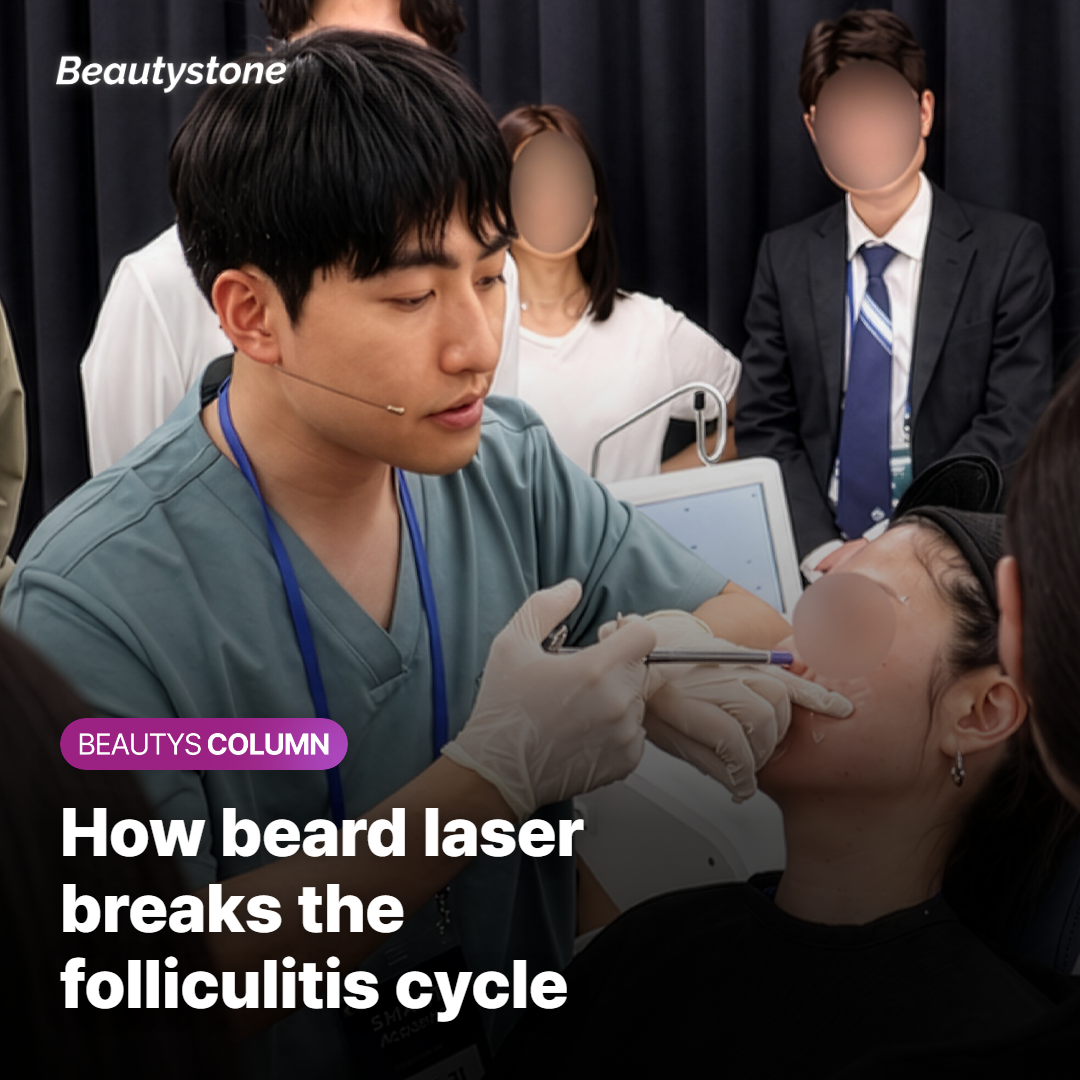 How beard laser hair removal breaks the folliculitis cycle