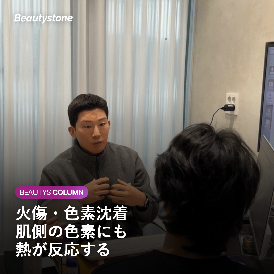 火傷や色素沈着など日焼け肌のレーザー脱毛リスクを示すイメージ