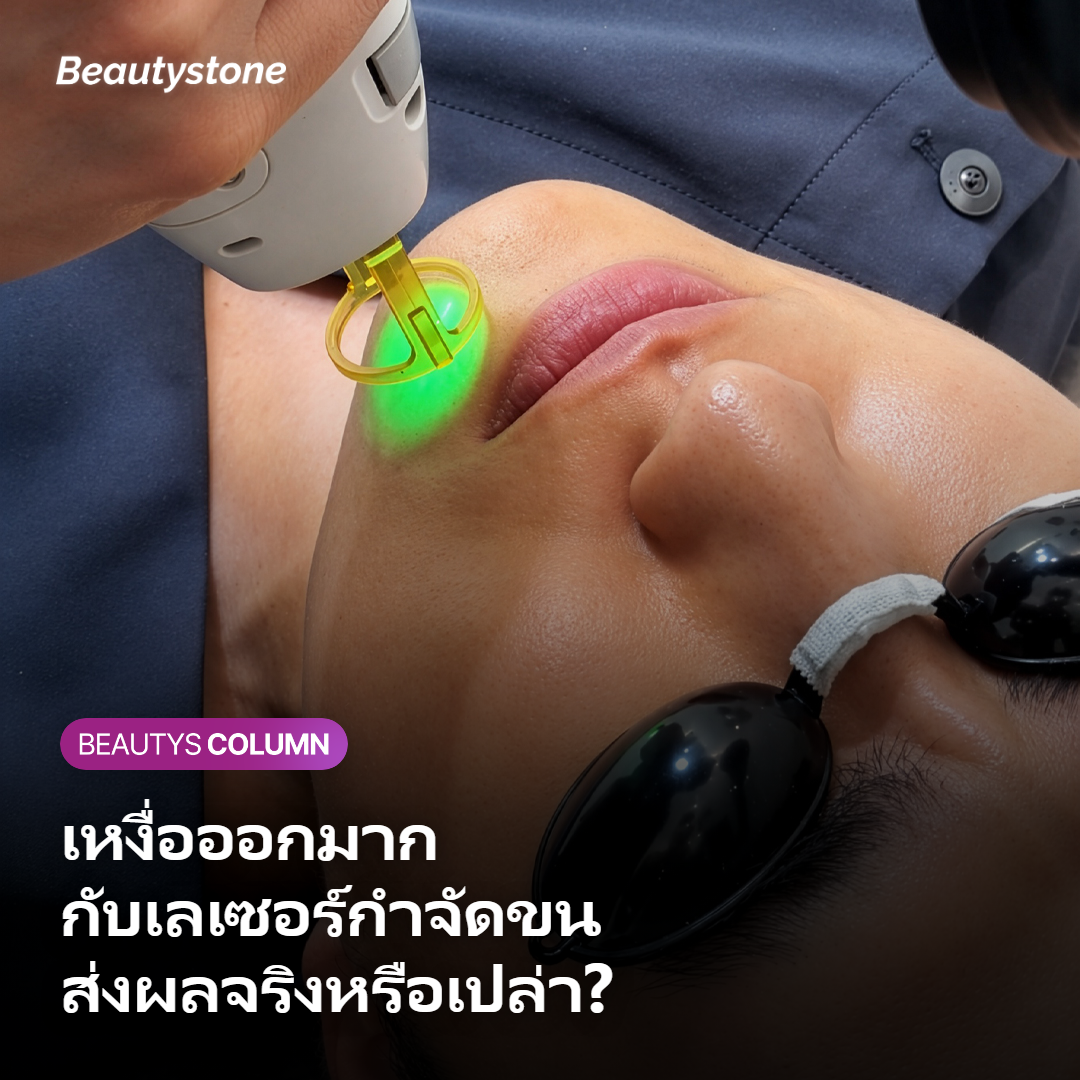 ภาวะเหงื่อออกมากส่งผลต่อเลเซอร์กำจัดขนอย่างไร