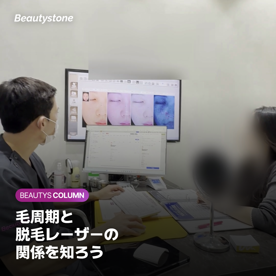 脱毛レーザーが成長期の毛根に作用する仕組みを示す皮膚断面図